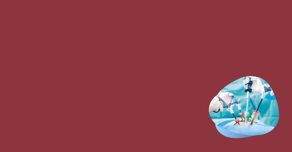 Laparoscopic Treatment | Narayana Hospitals Safe & Fast Care